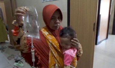 Bakti-Kesehatan-di-Hari-Bhayangkara-ke--78-Polres-Bondowoso-Gelar-Operasi-Bibir-Sumbing-Gratis